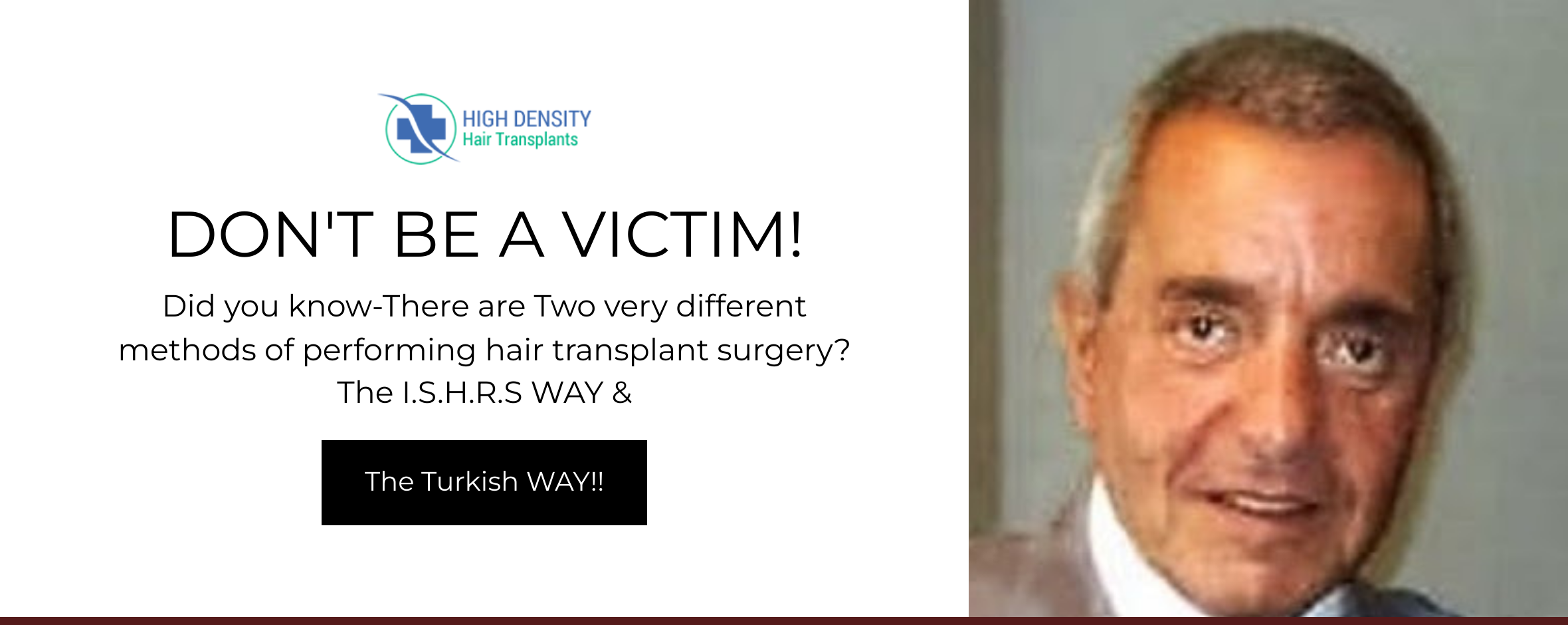 Hair Transplant Price War