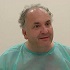 hair transplants