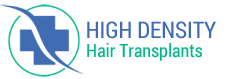 High Density Hair Transplants